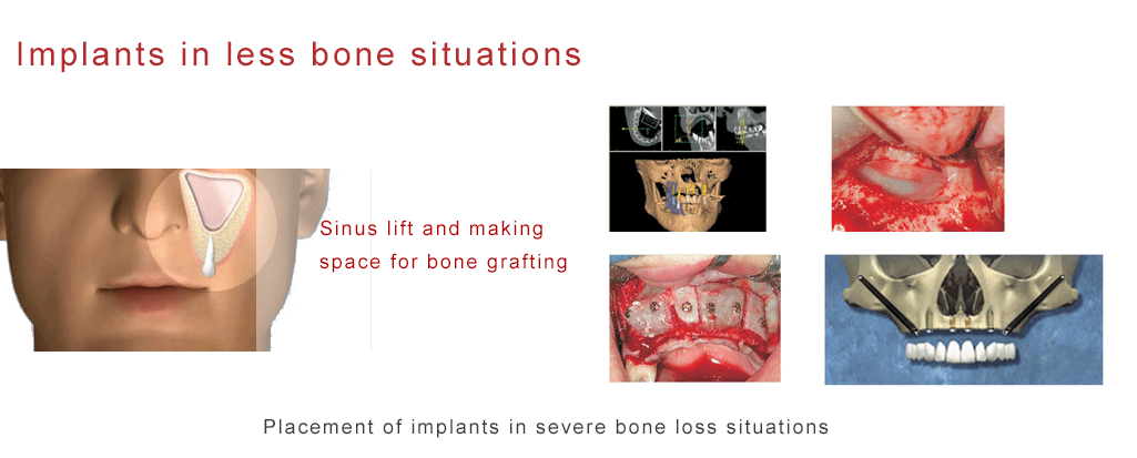 Mukha Facial Surgery & Dental Implant Center