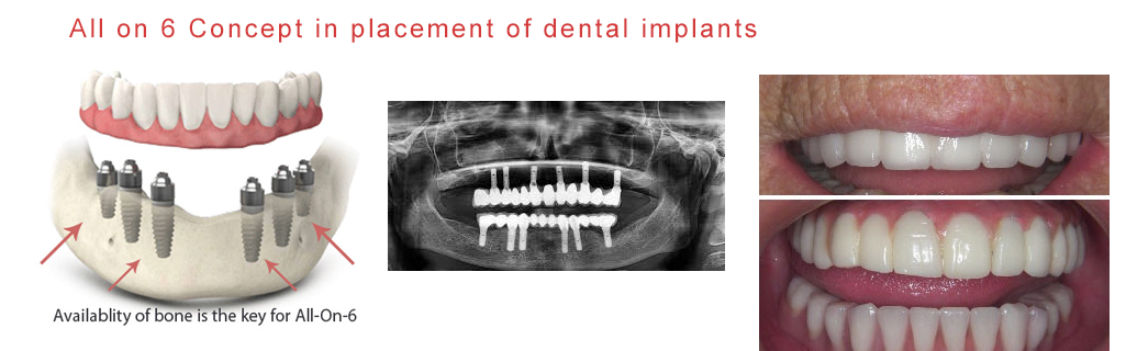 Mukha Facial Surgery & Dental Implant Center