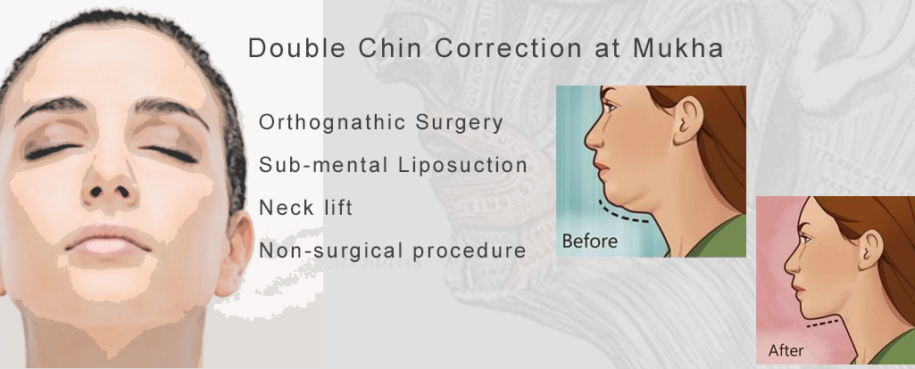 Mukha Facial Surgery & Dental Implant Center