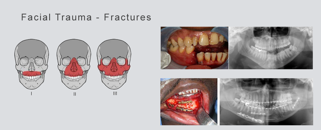 Mukha Facial Surgery & Dental Implant Center