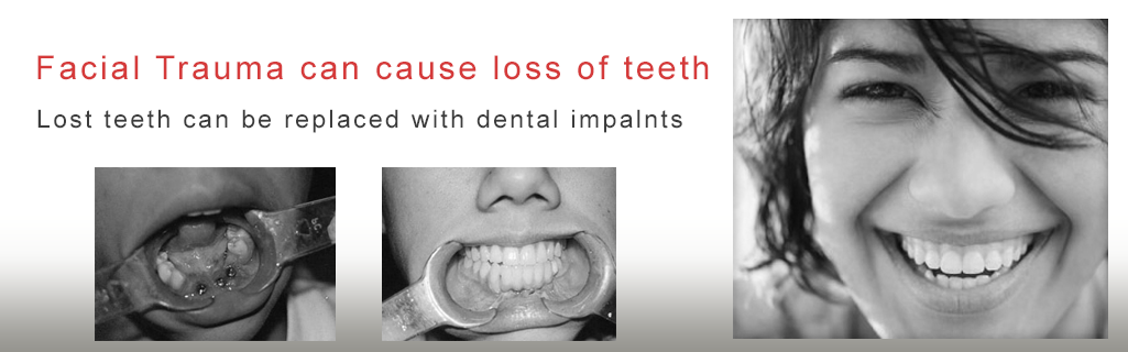 Mukha Facial Surgery & Dental Implant Center