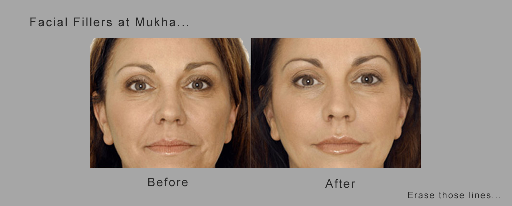 Mukha Facial Surgery & Dental Implant Center