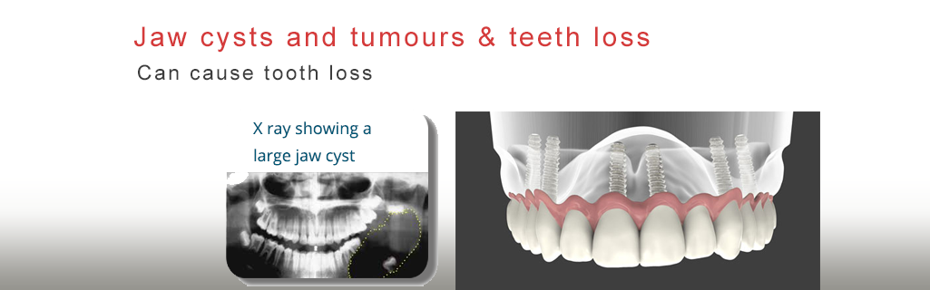 Mukha Facial Surgery & Dental Implant Center