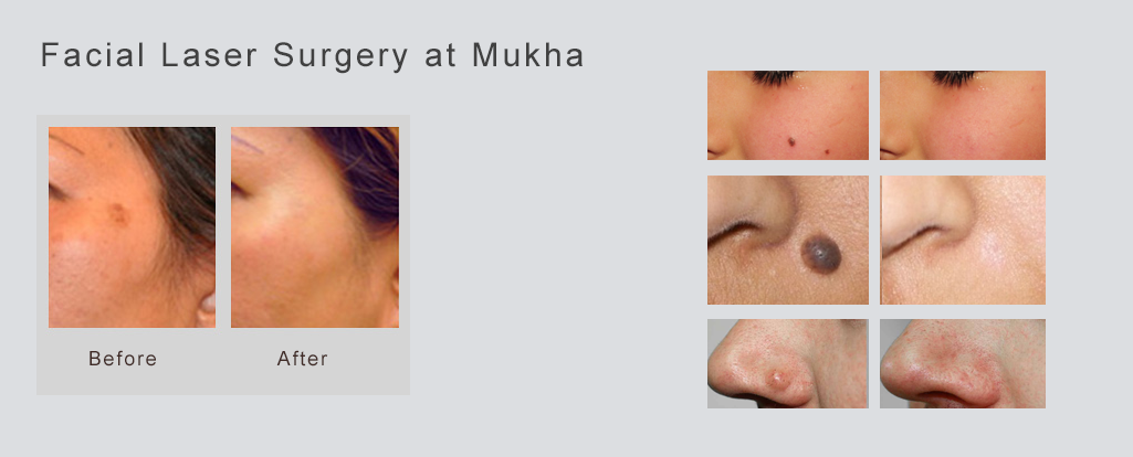 Mukha Facial Surgery & Dental Implant Center