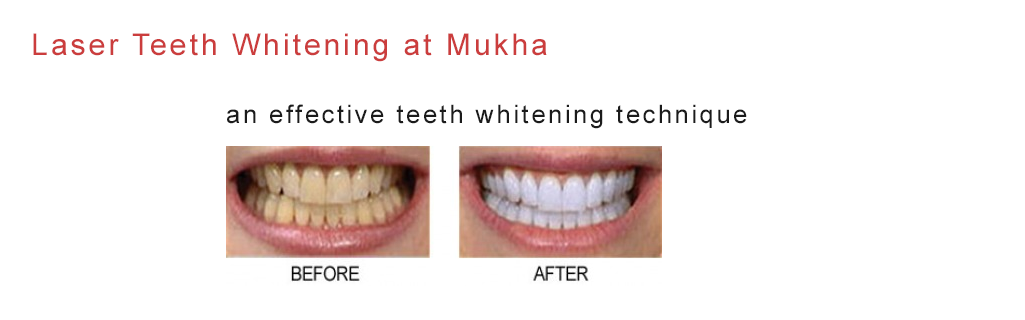 Mukha Facial Surgery & Dental Implant Center