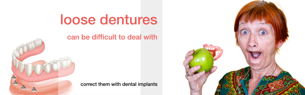 Loose dentures can be fixed with dental implants