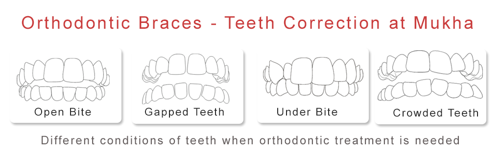 Mukha Facial Surgery & Dental Implant Center
