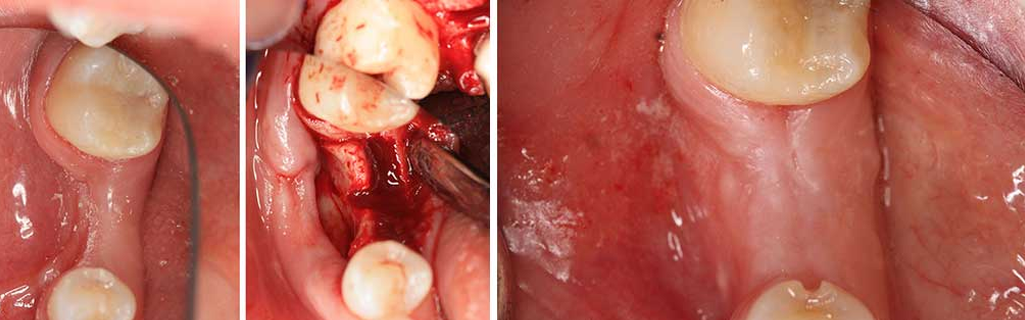 Mukha Facial Surgery & Dental Implant Center