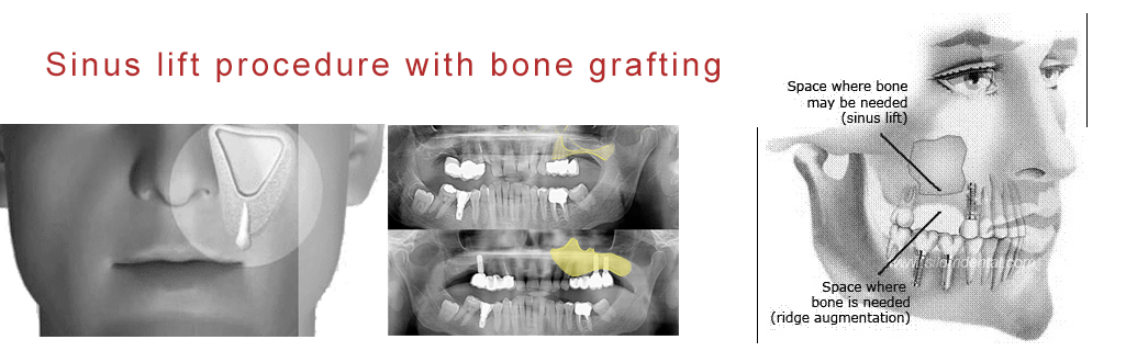 Mukha Facial Surgery & Dental Implant Center