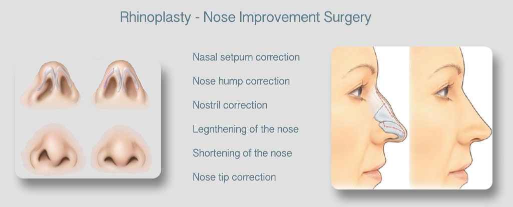 Mukha Facial Surgery & Dental Implant Center